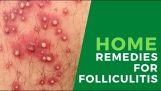 Top 6 Unusual and Powerful Home Remedies For Folliculitis
