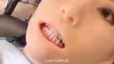 Robô de odontologia com defeito