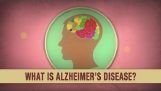 מהי מחלת אלצהיימר;