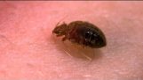 A Bedbug’s Bite – Up Close! – Bang Goes the Theory – BBC