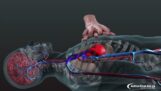 Cardiopulmonary resuscitation in 3D