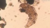 Såg celldelning i ett mikroskop, när plötsligt…