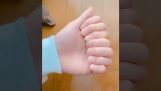 Uma mão com oito dedos