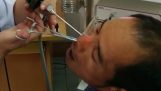 Γιατρός αφαιρεί μια βδέλλα από τη μύτη ενός άνδρα