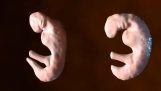 Εμβρυϊκή ανάπτυξη ενός ανθρώπου και ενός δελφινιού